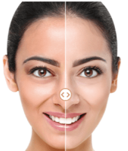 SKIN LIGHTENING & SKIN WHITENING TREATMENT BY TOP DERMATOLOGIST IN ISLAMABAD