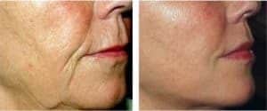 prof. Dr. Ikram Ullah Khan, best dermatologist in Islamabad, top dermatologist in Islamabad, Skin doctor, Consultant dermatologist, Cosmetologist