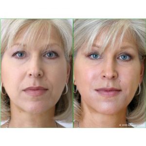 Prof. Dr. Ikram Ullah Khan, best dermatologist in Islamabad, top dermatologist in Islamabad, Skin doctor, Consultant dermatologist, Cosmetologist