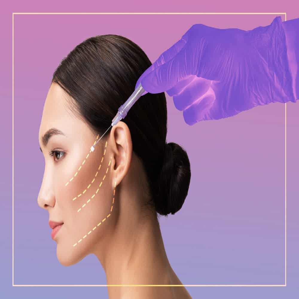 Thread Lift Aesthetic Magic by Prof Dr Ikram Ullah Khan