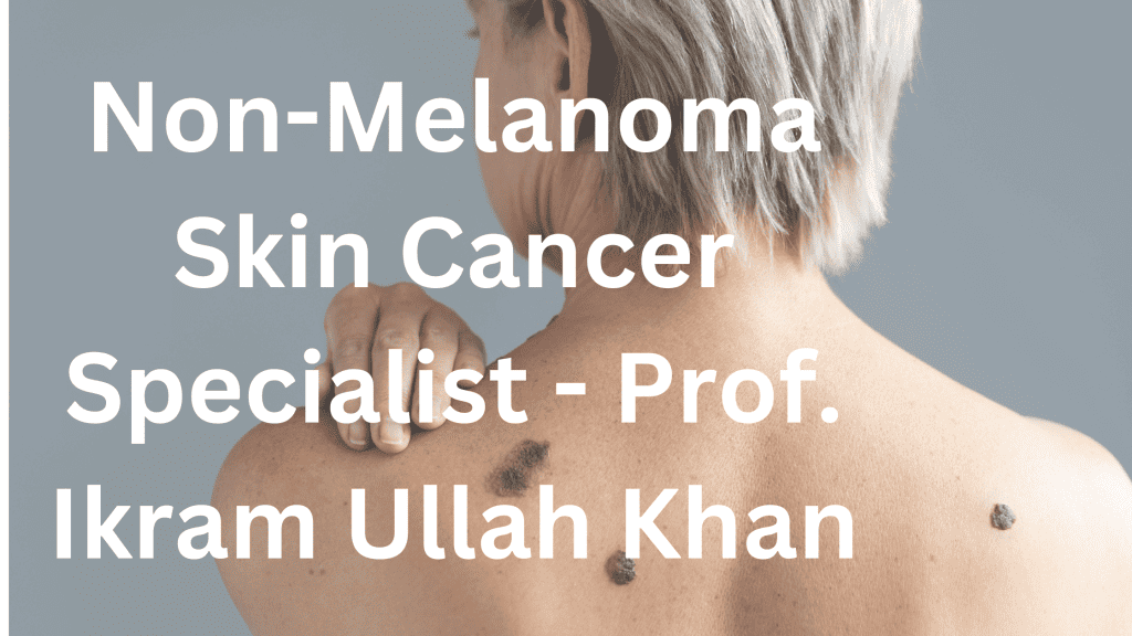 Non-Melanoma Skin Cancer Specialist – Prof. Ikram Ullah Khan